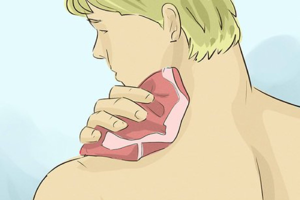 cách làm tan nhanh vết hickey